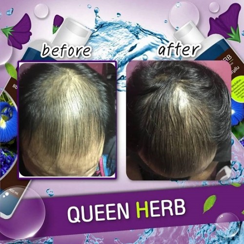 Bộ Dầu Gội Xả Dưỡng Tóc Queen Herb x2 Up Herbal Thái Lan