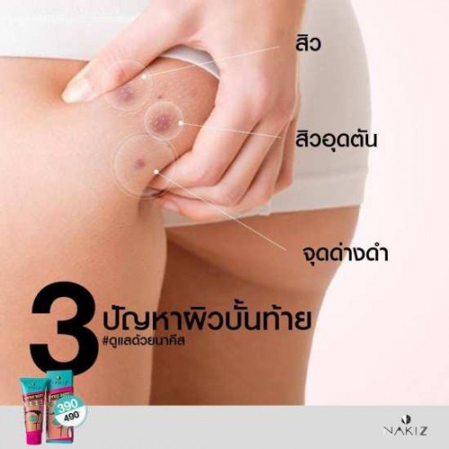 Kem Trị Thâm Mông Nakiz Lively Butt 100g Thái Lan