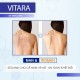 Xịt Trị Mụn Lưng Và Ngực Vitara SE Body Acne Spray 50ml Thái Lan