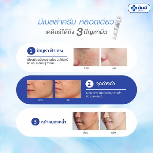 Combo 3 Tuýp Kem Trị Nám Da Mặt Yanhee Mela Cream 20g Thái Lan