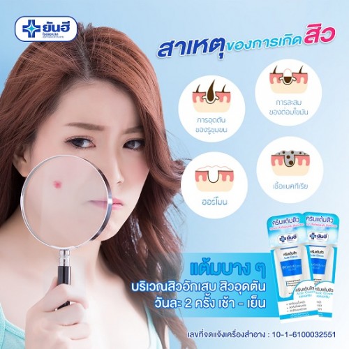 Kem Trị Mụn Yanhee Acne Cream 10g Thái Lan [Nhập Khẩu Chính Hãng]