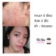 Viên Uống Trị Mụn Trắng Da CL Collagen By Prime Thái Lan